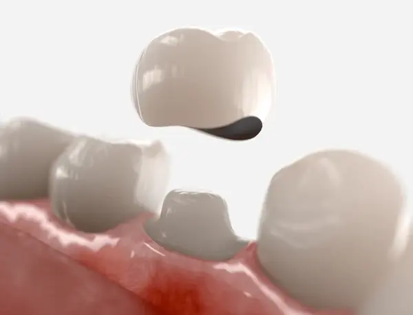 dental crowns for kids near you