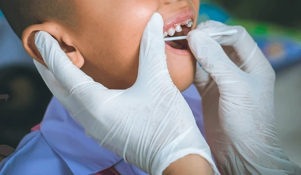fluoride treatment for children near you