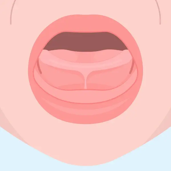 tongue tie treatment for infants in nashville